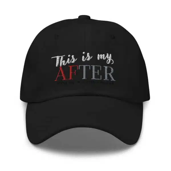 "This is My AFTER" Baseball Cap MDF